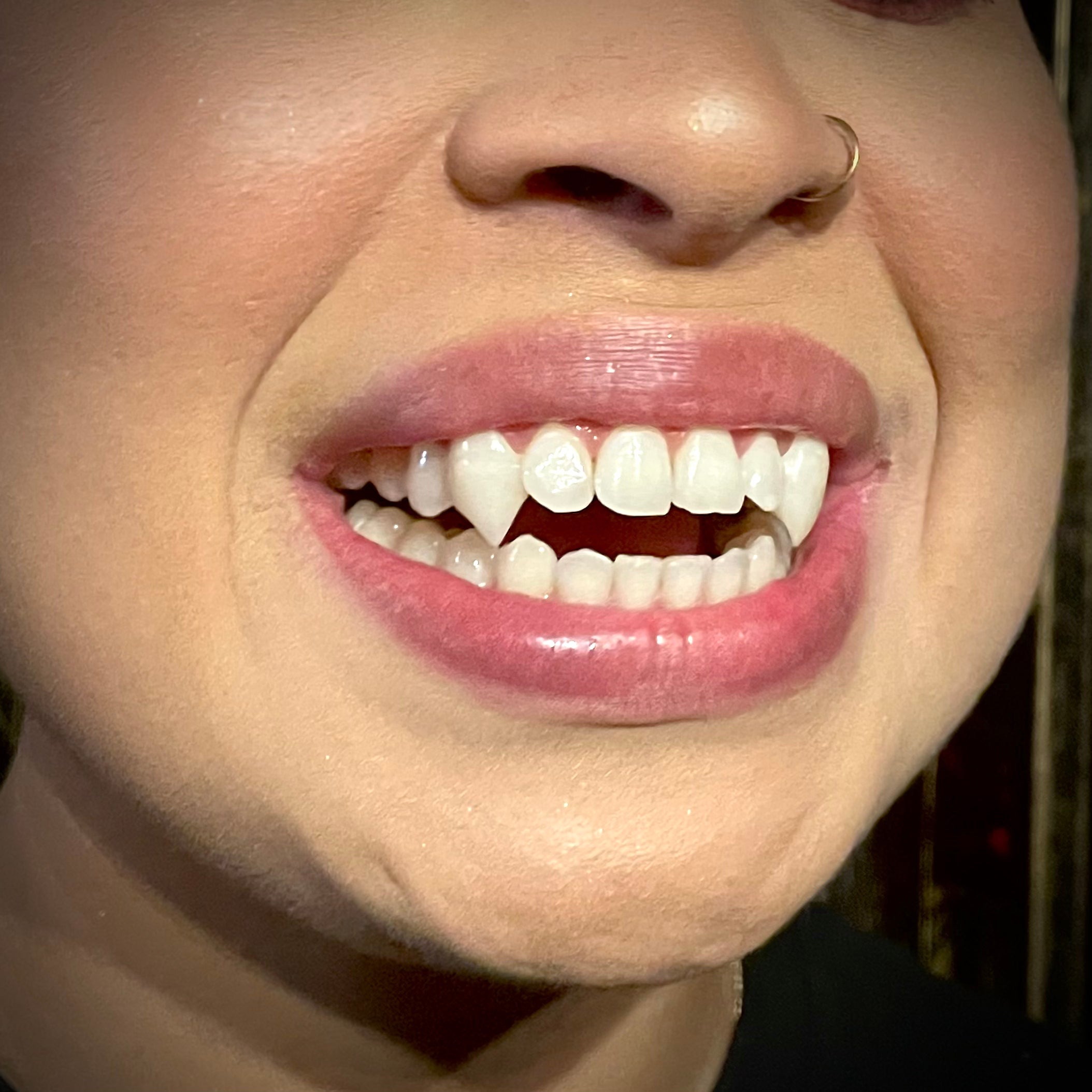 permanent vampire teeth caps